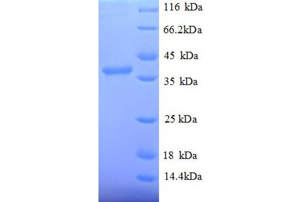 SRP14 Protein (AA 2-108, partial) (GST tag)