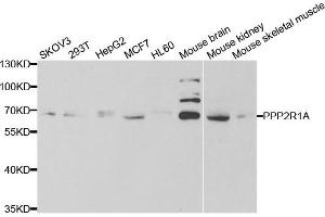 Western blot analysis of extracts of various cell lines, using PPP2R1A antibody. (PPP2R1A anticorps)