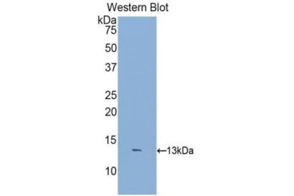 DKK2 anticorps  (AA 159-258)