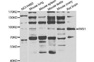 Western blot analysis of extracts of various cell lines, using IWS1 antibody. (IWS1 anticorps)