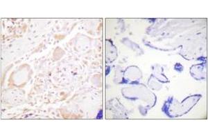 Immunohistochemistry (IHC) image for anti-GATA Binding Protein 3 (GATA3) (AA 274-323) antibody (ABIN2888838) (GATA3 anticorps  (AA 274-323))