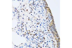 Immunohistochemistry of paraffin-embedded rat lung using MTA3 antibody (ABIN5974011) at dilution of 1/100 (40x lens). (MTA3 anticorps)