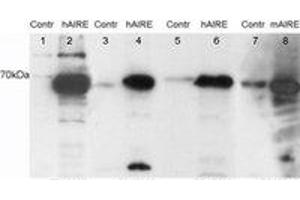 Image no. 1 for anti-Autoimmune Regulator (AIRE) (C-Term) antibody (ABIN374235) (AIRE anticorps  (C-Term))