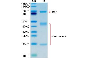 Human GARP(Y137H&S138G&G139N)&Latent TGF Beta Complex on Tris-Bis PAGE under reduced condition. (GARP & Latent TGF beta 1 Complex (Gly139Asn-Mutant), (Ser138Gly-Mutant), (Tyr137His-Mutant) protein (His-Avi Tag))