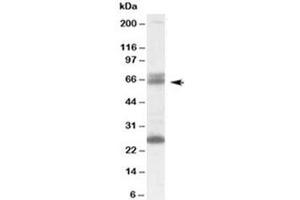 Western blot testing of human brain lysate with GAD65 antibody at 0. (GAD65 anticorps)