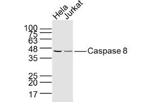 Lane 1: hela lysates Lane 2: jurkat lysates probed with Caspase 8 Monoclonal Polyclonal Antibody, Unconjugated  at 1:300 dilution and 4˚C overnight incubation. (Caspase 8 anticorps)