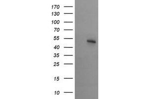 Image no. 3 for anti-serine/threonine Kinase 38 Like (STK38L) (AA 1-281) antibody (ABIN1490700) (STK38L anticorps  (AA 1-281))