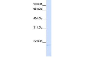 C14ORF180 antibody used at 1 ug/ml to detect target protein. (C14orf180 anticorps  (Middle Region))