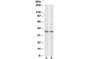 Western blot testing of human heart [A] and lung [B] lysates with KLF2 antibody at 1ug/ml. (KLF2 anticorps)