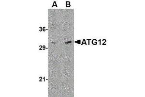 Western Blotting (WB) image for anti-Autophagy Related 12 (ATG12) (N-Term) antibody (ABIN2477525) (ATG12 anticorps  (N-Term))
