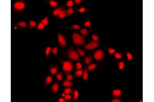 Immunofluorescence analysis of A549 cells using MLF1 antibody (ABIN5974950). (MLF1 anticorps)