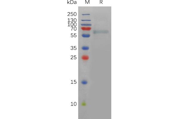 FURIN Protein (AA 27-574) (His tag)