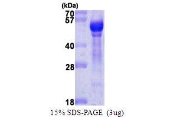 Angiopoietin 1 Protein (ANGPT1) (AA 20-498)