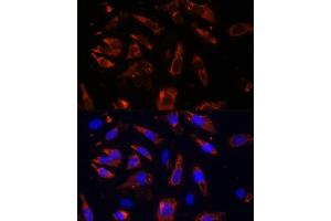 Immunofluorescence analysis of U-2OS cells using MCTS1 antibody (ABIN6132341, ABIN6143657, ABIN6143658 and ABIN6224877) at dilution of 1:100 (40x lens). (MCTS1 anticorps  (AA 1-181))