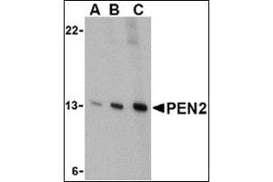 Western blot analysis of PEN2 in K562 cell lysate with this product at (A) 0. (PEN2 anticorps  (C-Term))