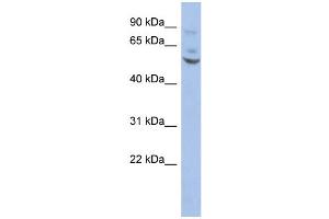 WB Suggested Anti-ETV1 Antibody Titration:  0. (ETV1 anticorps  (Middle Region))