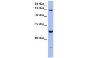 Image no. 1 for anti-MutS Homolog 6 (E. Coli) (MSH6) (AA 251-300) antibody (ABIN6743061) (MSH6 anticorps  (AA 251-300))
