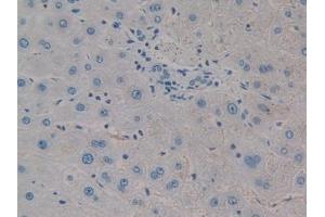 DAB staining on IHC-P; Samples: Human Liver Tissue (CTHRC1 anticorps  (AA 31-243))