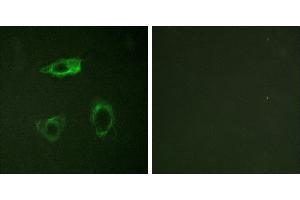 P-peptide - +Western blot analysis of extracts from COS cells, treated with EGF (200ng/ml, 30mins), using CD18/ITGB2 (Phospho-Thr758) antibody. (Integrin beta 2 anticorps  (pThr758))