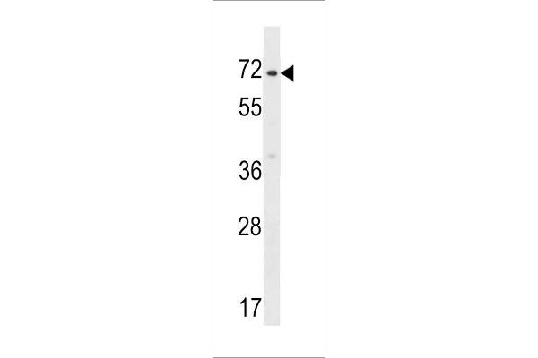 ZNF155 anticorps  (C-Term)