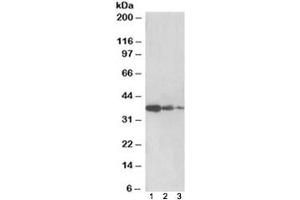 Western blot testing of human liver lysate [lane 1], mouse liver [lane 2] and rat liver [lane 3] with PP2A antibody at 0. (PPP2R4 anticorps)