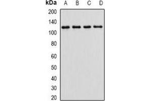 Western blot analysis of Alpha E-catenin expression in HEK293T (A), MCF7 (B), mouse kidney (C), mouse brain (D) whole cell lysates. (CTNNA1 anticorps)