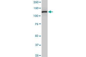 CAND1 monoclonal antibody (M03), clone 2D7. (CAND1 anticorps  (AA 1-100))