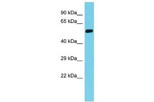 Host: Rabbit Target Name: MSANTD2 Sample Type: Fetal Heart lysates Antibody Dilution: 1. (MSANTD2 anticorps  (N-Term))