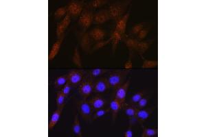 Immunofluorescence analysis of NIH-3T3 cells using PSMD4 Rabbit mAb (ABIN1681255, ABIN3017957, ABIN3017958 and ABIN7101547) at dilution of 1:100 (40x lens). (PSMD4/ASF anticorps)
