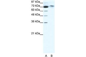 Human HepG2; WB Suggested Anti-C14ORF101 Antibody Titration: 0. (C14orf101 anticorps  (N-Term))