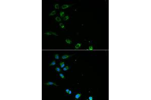 Immunofluorescence analysis of MCF7 cell using HFE antibody. (HFE anticorps)