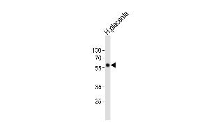 Western blot analysis of lysate from human placenta tissue lysate, using FOXO4 Antibody (C-term) (ABIN6242148 and ABIN6577869). (FOXO4 anticorps  (C-Term))