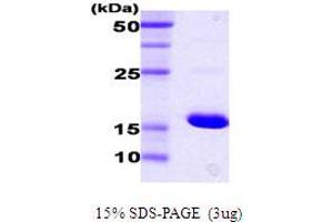 SDS-PAGE (SDS) image for DnaK (AA 385-546) protein (ABIN666828) (DnaK (AA 385-546) Protéine)