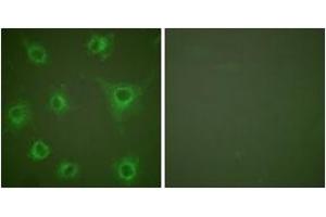 Immunofluorescence analysis of COS7 cells, using Collagen II Antibody. (COL2 anticorps  (AA 101-150))