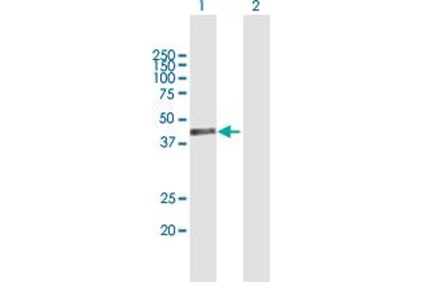 Protein Tob1 (TOB1) (AA 1-345) anticorps