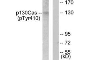 Western blot analysis of extracts from NIH-3T3 cells, using p130 Cas (Phospho-Tyr410) Antibody. (BCAR1 anticorps  (pTyr410))