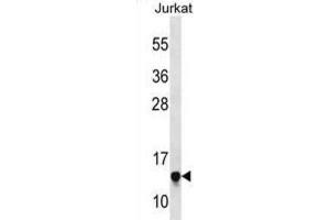 Western Blotting (WB) image for anti-Ribosomal Protein S23 (RPS23) antibody (ABIN3000361) (RPS23 anticorps)