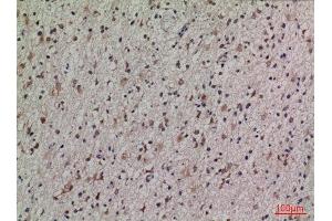 Immunohistochemistry (IHC) analysis of paraffin-embedded Human Brain, antibody was diluted at 1:100. (Lipocalin 1 anticorps  (Internal Region))