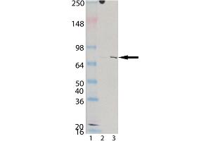 Western blot analysis of KIM-1 (human), mAb (3F4) : Lane 1: MW marker, Lane 2: HeLa, (cell lysate) , Lane 3: CaKi-2 (cell lysate). (HAVCR1 anticorps)