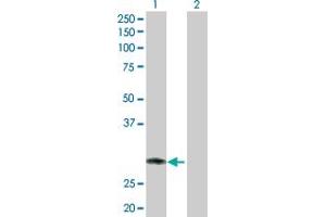 Western Blot analysis of RNF144B expression in transfected 293T cell line by RNF144B MaxPab polyclonal antibody. (RNF144B anticorps  (AA 1-302))