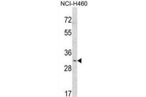 Western Blotting (WB) image for anti-SNAI antibody (ABIN2912021) (SNAI anticorps)