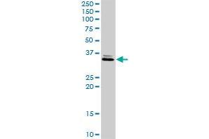 RDHE2 MaxPab rabbit polyclonal antibody. (SDR16C5 anticorps  (AA 1-309))