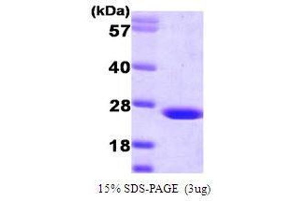 BLVRB Protein (AA 1-206)