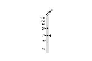 Western blot analysis of lysate from human lung tissue lysate, using MFAP4 Antibody at 1:1000 at each lane. (MFAP4 anticorps  (C-Term))