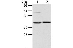 Western Blot analysis of Mouse brain and liver tissue using HIF1AN Polyclonal Antibody at dilution of 1:200 (HIF1AN anticorps)