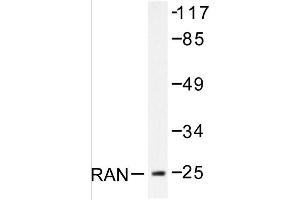 Image no. 1 for anti-RAN, Member RAS Oncogene Family (RAN) antibody (ABIN271799) (RAN anticorps)