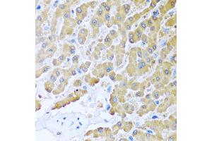 Immunohistochemistry of paraffin-embedded human liver using CCL8 antibody (ABIN5975074) at dilution of 1/100 (40x lens). (CCL8 anticorps)