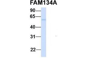 Host:  Rabbit  Target Name:  FAM134A  Sample Type:  Human Fetal Heart  Antibody Dilution:  1. (FAM134A anticorps  (N-Term))