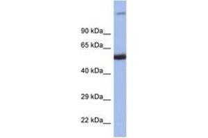 Image no. 1 for anti-Interferon Regulatory Factor 8 (IRF8) (C-Term) antibody (ABIN6747508) (IRF8 anticorps  (C-Term))