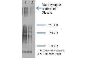 Western Blot analysis of Rat and mouse brain lysates showing detection of Piccolo protein using Mouse Anti-Piccolo Monoclonal Antibody, Clone 6H9-B6 . (Piccolo anticorps  (PE))